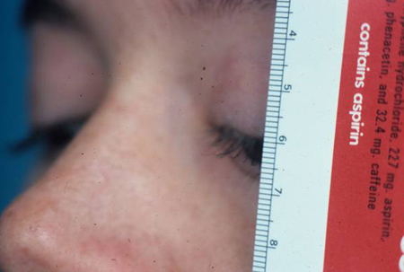 com.bmj.content.model.assessment.Caption@408adf97