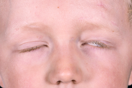 com.bmj.content.model.assessment.Caption@34a18d83