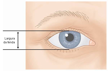 com.bmj.content.model.assessment.Caption@107e9d9f