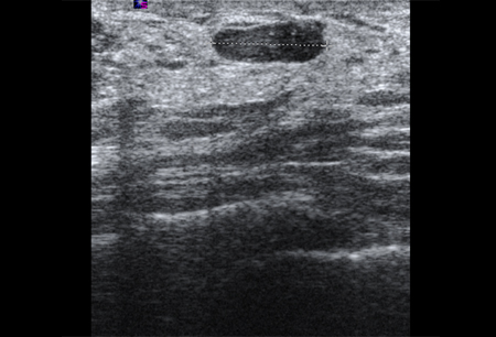 Assessment of breast mass images