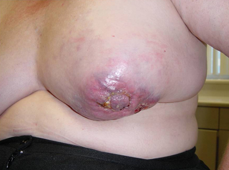com.bmj.content.model.assessment.Caption@4167a08d