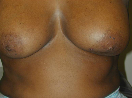 com.bmj.content.model.assessment.Caption@64d38b52