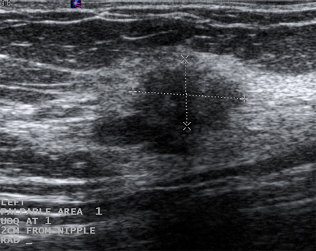com.bmj.content.model.assessment.Caption@6bc401ea
