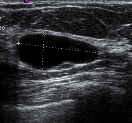 com.bmj.content.model.assessment.Caption@64386ad5