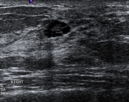 com.bmj.content.model.assessment.Caption@12abc90c