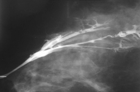 com.bmj.content.model.assessment.Caption@4893c11a