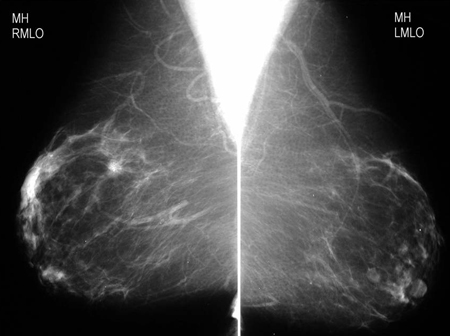 com.bmj.content.model.assessment.Caption@3cd280bd