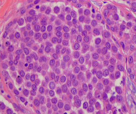com.bmj.content.model.assessment.Caption@385c18e8