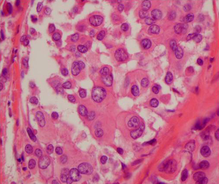 com.bmj.content.model.assessment.Caption@73e92b9c