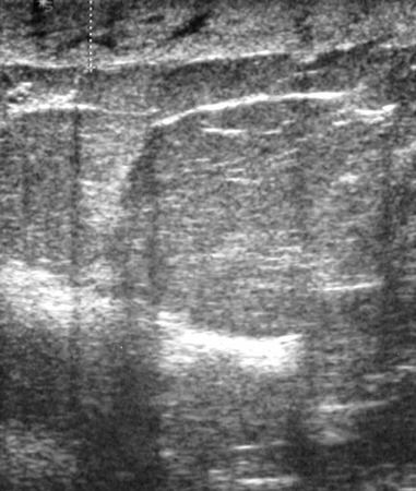 com.bmj.content.model.assessment.Caption@70d9e8b2