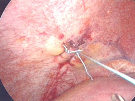 com.bmj.content.model.assessment.Caption@564cd88d