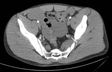 com.bmj.content.model.assessment.Caption@7a23c5c7