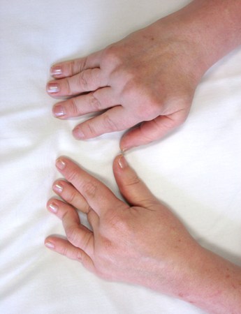 com.bmj.content.model.assessment.Caption@24ce8e6a