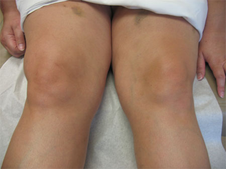com.bmj.content.model.assessment.Caption@157592d0