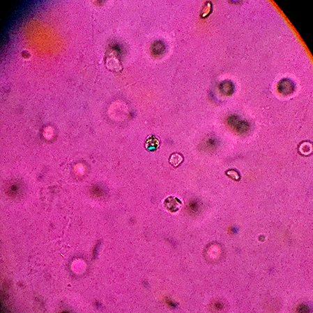 com.bmj.content.model.assessment.Caption@df9609b