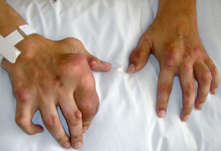 com.bmj.content.model.assessment.Caption@5b552fa9