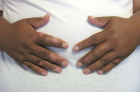 com.bmj.content.model.assessment.Caption@2aeef668