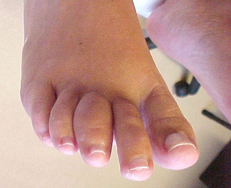 com.bmj.content.model.assessment.Caption@7e783c09