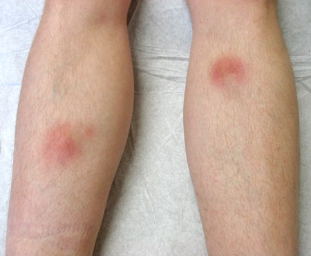 com.bmj.content.model.assessment.Caption@37758ce