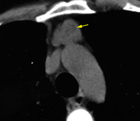 com.bmj.content.model.Caption@5274ccd1