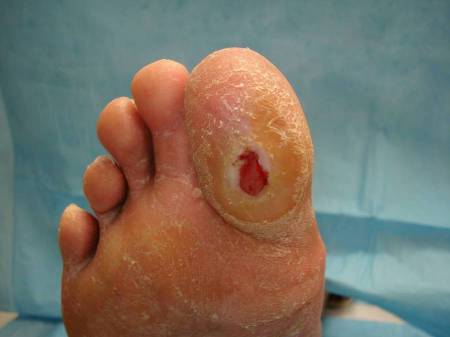 com.bmj.content.model.assessment.Caption@3bd645ae