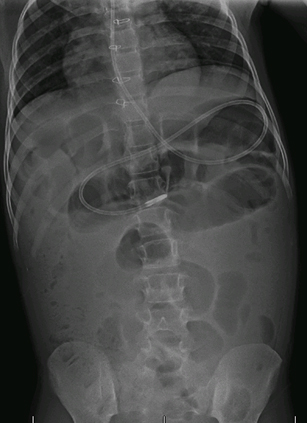 com.bmj.content.model.assessment.Caption@625d6fdf