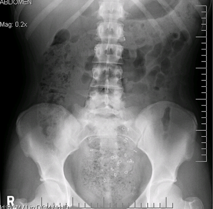com.bmj.content.model.assessment.Caption@53b1ca85