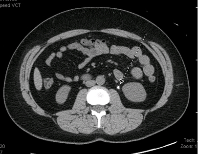 com.bmj.content.model.assessment.Caption@441e86c6