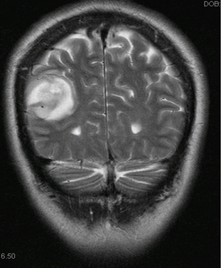 com.bmj.content.model.assessment.Caption@6f2162e0