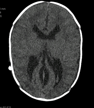 com.bmj.content.model.assessment.Caption@6d218047