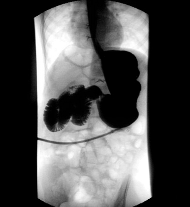 com.bmj.content.model.assessment.Caption@7cb79a90