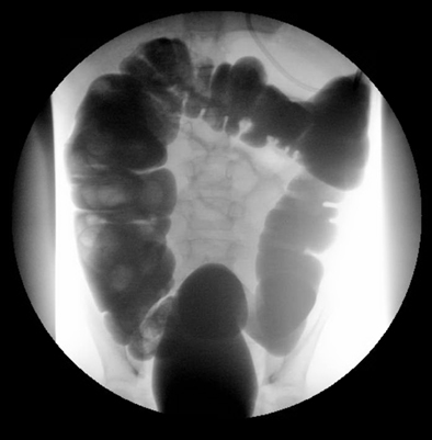 com.bmj.content.model.assessment.Caption@21a9ec4c