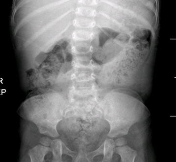 com.bmj.content.model.assessment.Caption@6703d2ef