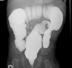 com.bmj.content.model.assessment.Caption@2a329610