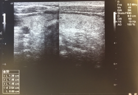 com.bmj.content.model.assessment.Caption@4f1cfe61