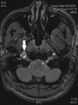 com.bmj.content.model.Caption@6eed6294