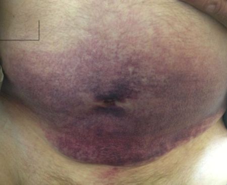 com.bmj.content.model.assessment.Caption@32f4539