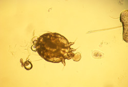 Scabies images