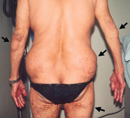 com.bmj.content.model.Caption@2896770b