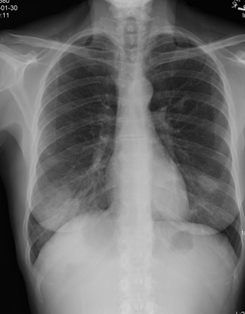 com.bmj.content.model.Caption@953e62f