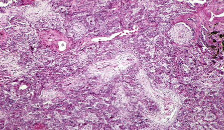 com.bmj.content.model.Caption@314561f1