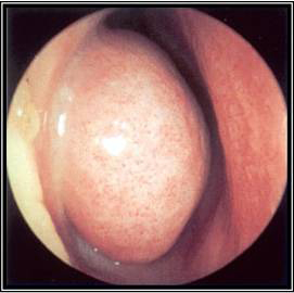 com.bmj.content.model.Caption@72f712bc