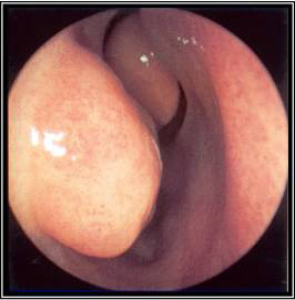 com.bmj.content.model.Caption@6775dae1