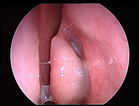 com.bmj.content.model.Caption@72dee1a8