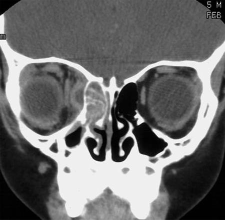 com.bmj.content.model.Caption@736f9914