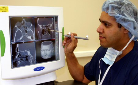 Rinossinusite crônica sem pólipos nasais images