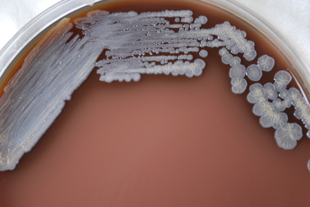 Melioidosis and glanders images