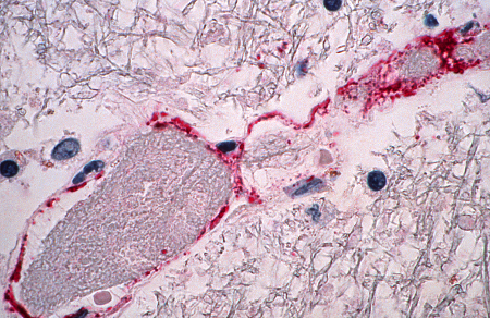 Henipaviruses images
