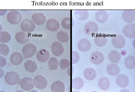 Malária images