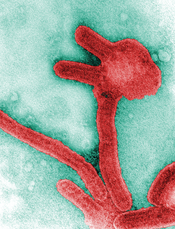 Marburg virus infection images